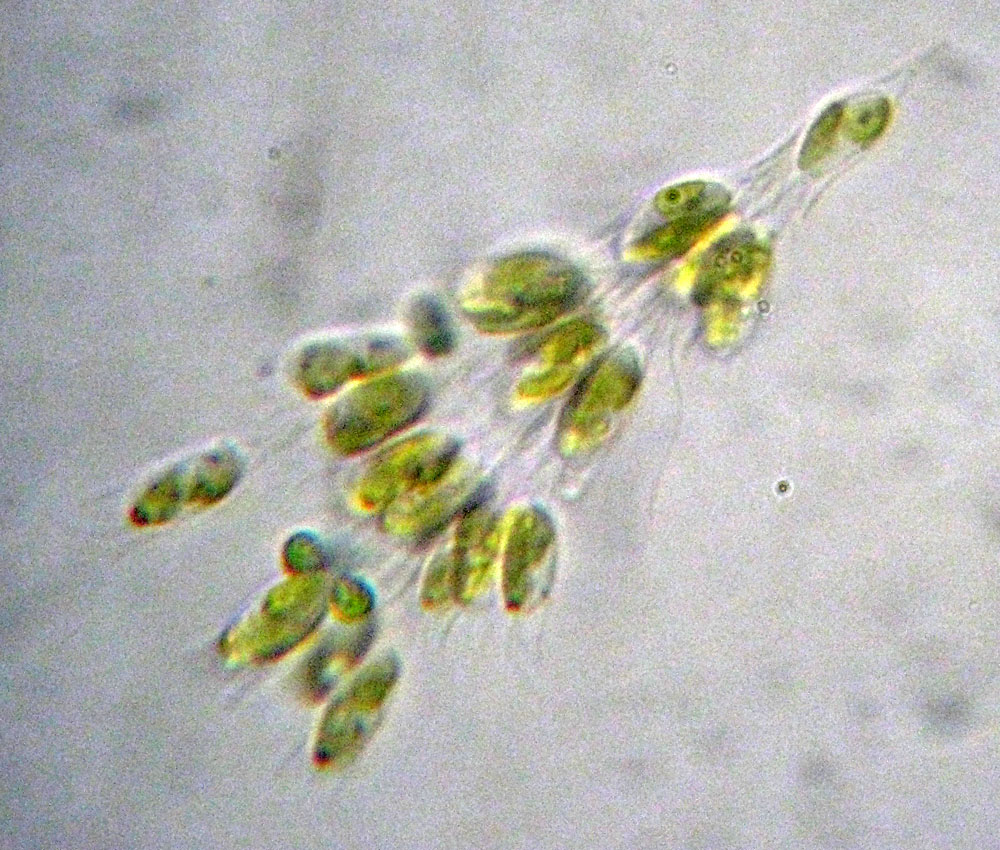 Dinobryon forse sertularia